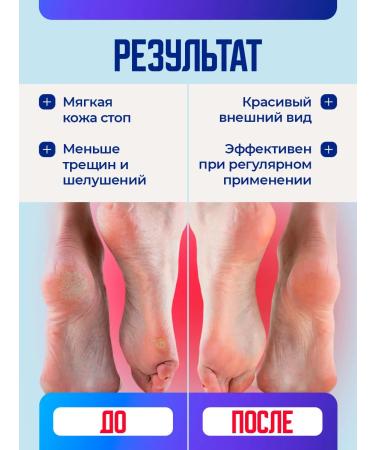 Novosvit Feet cream with urea acids for heels 150 ml - Buy Online on GoSupps.com