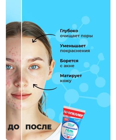 PROPELLER Salicylic pimpling gel for washing the face - Buy Online on GoSupps.com