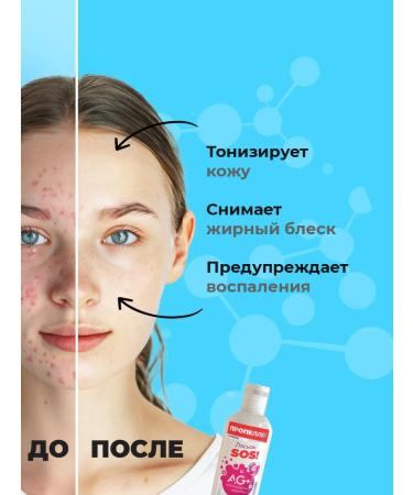 PROPELLER Facial Lotion Cleaning Acne 200ml - Buy Online on GoSupps.com