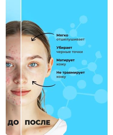 PROPELLER Face scrub from black dots with bamboo coal 100ml - Buy Online on GoSupps.com