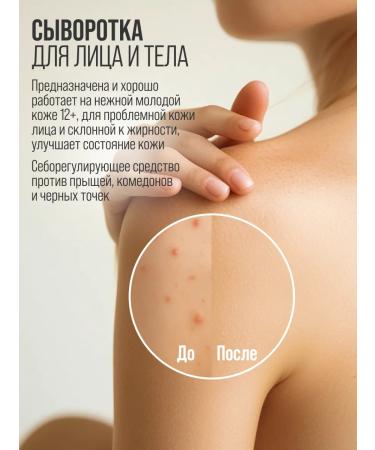 7DAYS Facial serum from acne with niacinamide 40ml - Buy Online on GoSupps.com