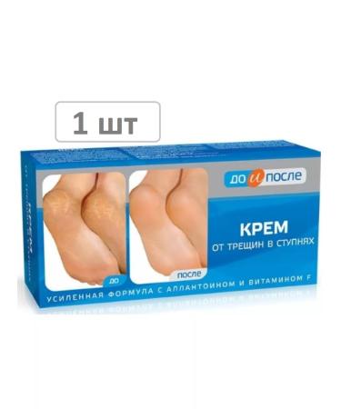 Before and After Cream from cracks in the feet of 150 ml - 1 pc