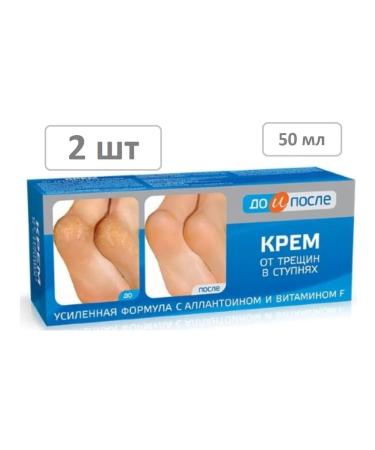 Before and After Cream from cracks in the feet of 50 ml - 2 pcs