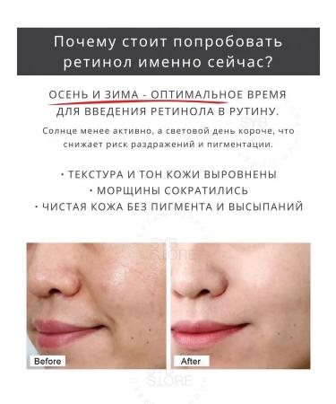 Skin&Lab Serum with retinol for the face and neck - Buy Online on GoSupps.com