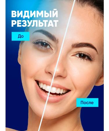 Feoir Paths for the eyes from edema and bags hydrogel 240 pcs - Buy Online on GoSupps.com