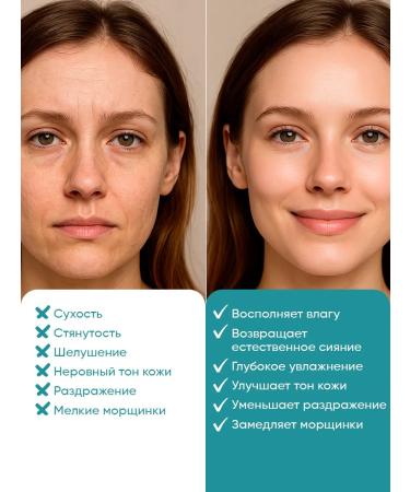 VEZE The face -moisturizer with hyalurocic acid 100 ml - Buy Online on GoSupps.com