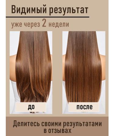 SuEl' Hair and skin broccoli oil - Buy Online on GoSupps.com