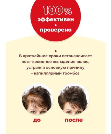 Esvicin Lotion Tonik spray for hair growth 250 ml - Buy Online on GoSupps.com