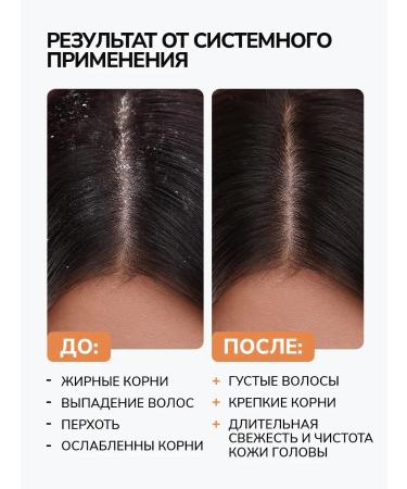 Y&B Piling for scalp and hair acidic with dandruff - Buy Online on GoSupps.com