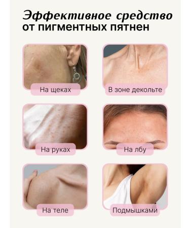 Apoterm Facial serum with acids whitening from pigmentation - Buy Online on GoSupps.com