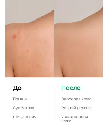 Likato professional Moisturizing body milk from acne 250 ml - Buy Online on GoSupps.com