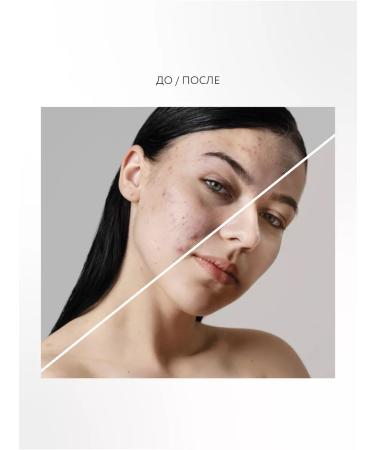 Crimean rose The mask deeply piercing from inflammation of acne and black dots - Buy Online on GoSupps.com