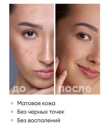 Etude House Foam for washing the face from acne - Buy Online on GoSupps.com