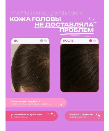 mamaBINU Mama binu dandruff shampoo "Ambulans" - Buy Online on GoSupps.com