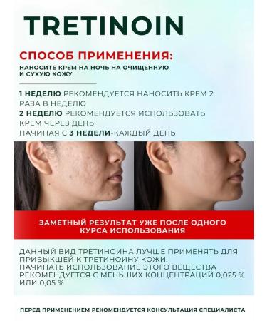 Menarini Tretinoin gel 0.1% of acne and black dots rejuvenating - Buy Online on GoSupps.com