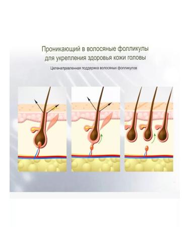 Yedda Anti-hair loss shampoo - Buy Online on GoSupps.com