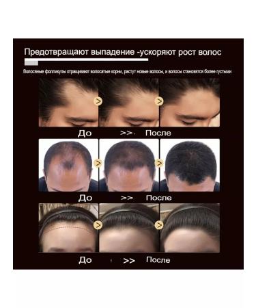 Melao Organic serum from hair loss - Buy Online on GoSupps.com