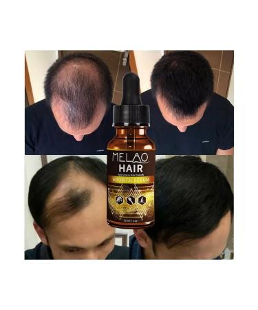 Melao Organic serum from hair loss - Buy Online on GoSupps.com