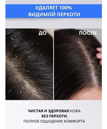 DR MARCUS HEILER Shampoo from dandruff and hair sera zinc sulsen - Buy Online on GoSupps.com