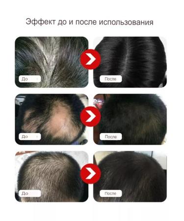 BUNEE Hair loss serum - Buy Online on GoSupps.com