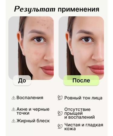 Apoterm Acneis serum and face mask - Buy Online on GoSupps.com