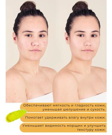 Skin Soft Cream wax from fractures for the legs and hands 3 pcs - Buy Online on GoSupps.com