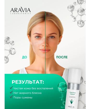 ARAVIA Washing gel with birch tar 150ml - Buy Online on GoSupps.com