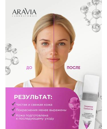 ARAVIA Washing gel for sensitive skin with rosacea 250ml - Buy Online on GoSupps.com