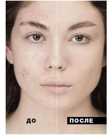 catrice Tonal cream HD Liquid Coverage 030 - Buy Online on GoSupps.com