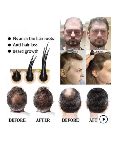 Coselita Hard black hair shampoo against hair loss - Buy Online on GoSupps.com