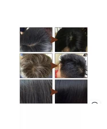 Coselita Hard black hair shampoo against hair loss - Buy Online on GoSupps.com