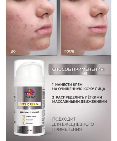 Pixeltap Cream against acne on the face 50 ml - Buy Online on GoSupps.com