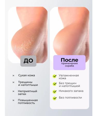 LIVSI Scrub for manicure pedicure of the body of the legs Babble gum - Buy Online on GoSupps.com