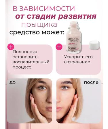 NEOGEN A dumping tool for acne with the Cica complex - Buy Online on GoSupps.com