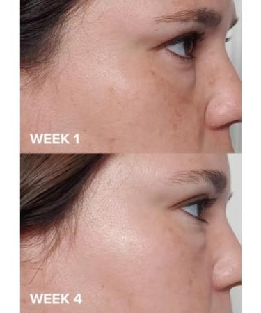 Paula's Choice Pilling tonic with salicylic acid 2% Bha Liquid - Buy Online on GoSupps.com