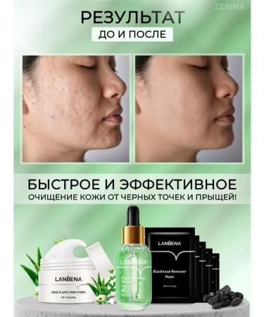 LANBENA Set of masks gift career beauty box for face - Buy Online on GoSupps.com