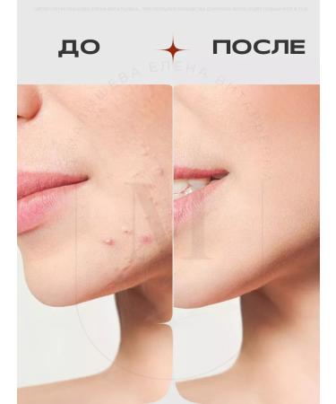 Cos De Baha Serum against inflammation and redness (AC) - Buy Online on GoSupps.com