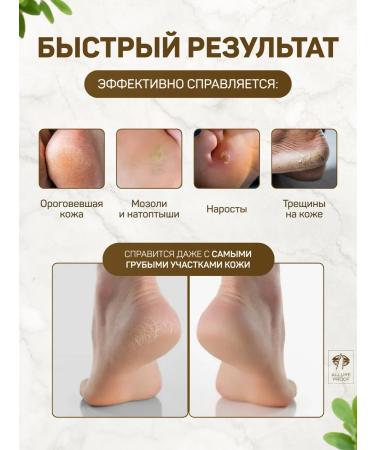 Allure Proof Grater for heels of legs Metal two -sided saw - Buy Online on GoSupps.com