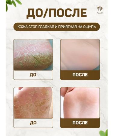 Allure Proof Grater for heels of legs Metal two -sided saw - Buy Online on GoSupps.com