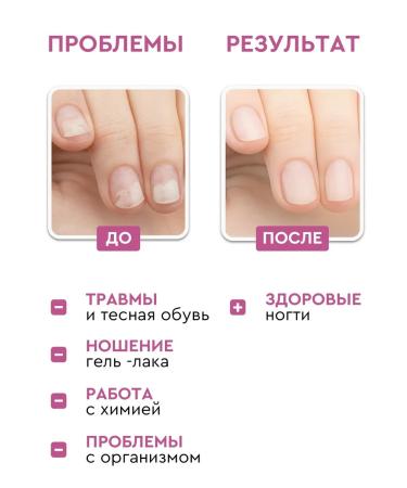 INKI Restoring nail oil and cuticles from onycholysis - Buy Online on GoSupps.com