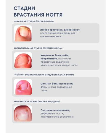 INKI Softening balm from ingrown nails and legs - Buy Online on GoSupps.com