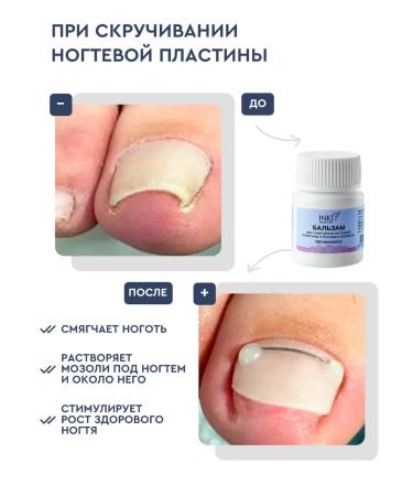 INKI Softening balm from ingrown nails and legs - Buy Online on GoSupps.com