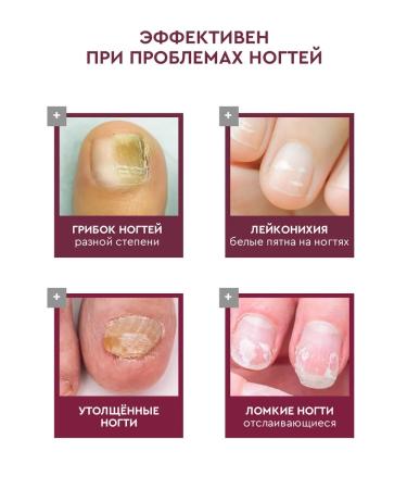 INKI Oil for cuticle and nails antifungal with calcium - Buy Online on GoSupps.com