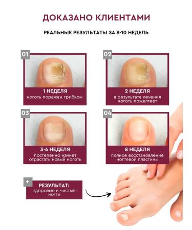 INKI Oil for cuticle and nails antifungal with calcium - Buy Online on GoSupps.com