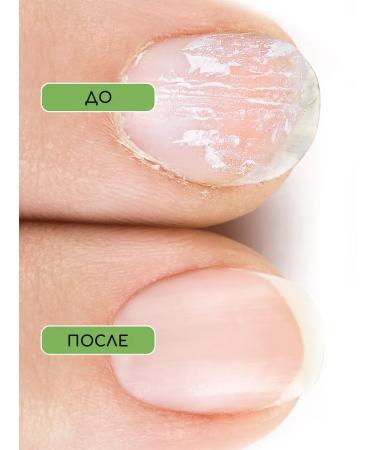 INKI Restoring serum for the treatment of nails with collagen - Buy Online on GoSupps.com