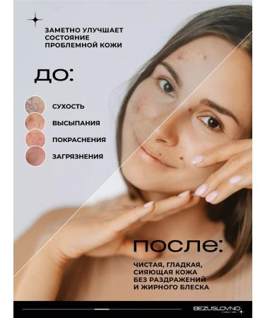 UNCONDITIONALLY Foam for washing the face 150 ml - Buy Online on GoSupps.com