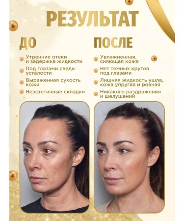 Petitfee Hydrogel patches for the eyes of Korea anti -aging from edema - Buy Online on GoSupps.com