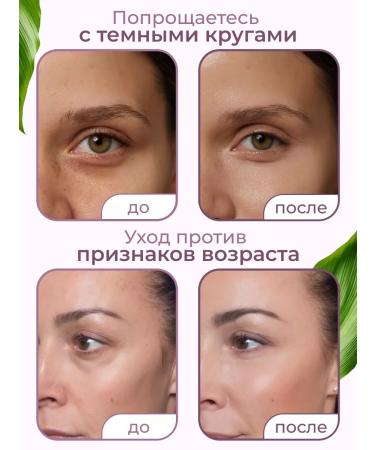 Koelf Hydrogel patches under the eyes of edema and dark circles - Buy Online on GoSupps.com