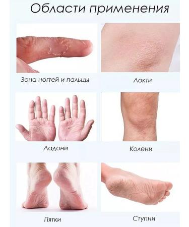 Norovstore Feet cream softening for dry and cracked skin - Buy Online on GoSupps.com