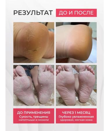 LOVE&JOY Feet cream from cracks and corns with urea moisturizing - Buy Online on GoSupps.com